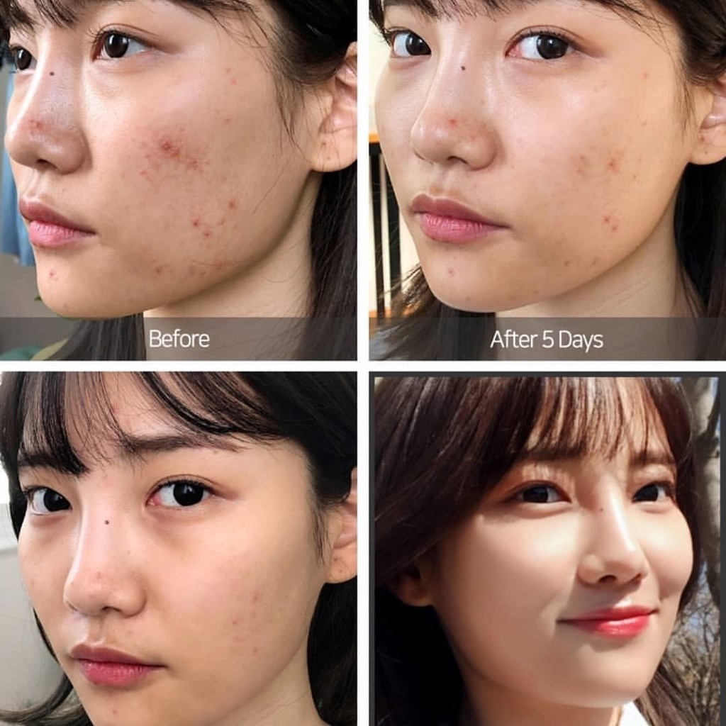 Serum sáng da se lỗ chân lông  Tinh chất Niacinamide 10% +Zin 1%