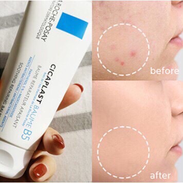 Kem Dưỡng Ẩm La Roche-Posay Cicaplast Baume B5 40ml,Gel B5 La Roche Posay Dưỡng Ẩm Phục Hồi Làn Da | BigBuy360 - bigbuy360.vn