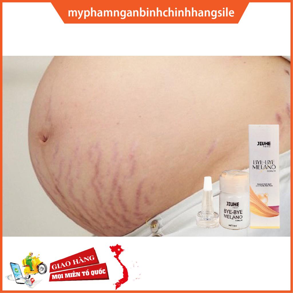 Serum mờ thâm hàn quốc JIUHE Q-PEARL giảm thâm do mụn khửu tay chân, thâm sẹo, thâm nách hiệu quả