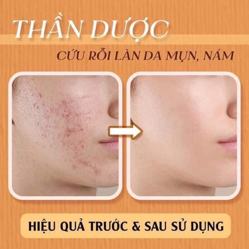 Cốt Huyết Thanh Thảo Dược 36 Vị - Meea Organic-Tái Tạo Da ,Ngừa mụn ,Phục Hồi Da chai 5ml( chính hãng 100%)