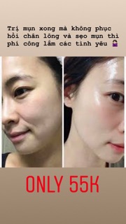 Serum tế bào gốc Eldas Eg Tox Program