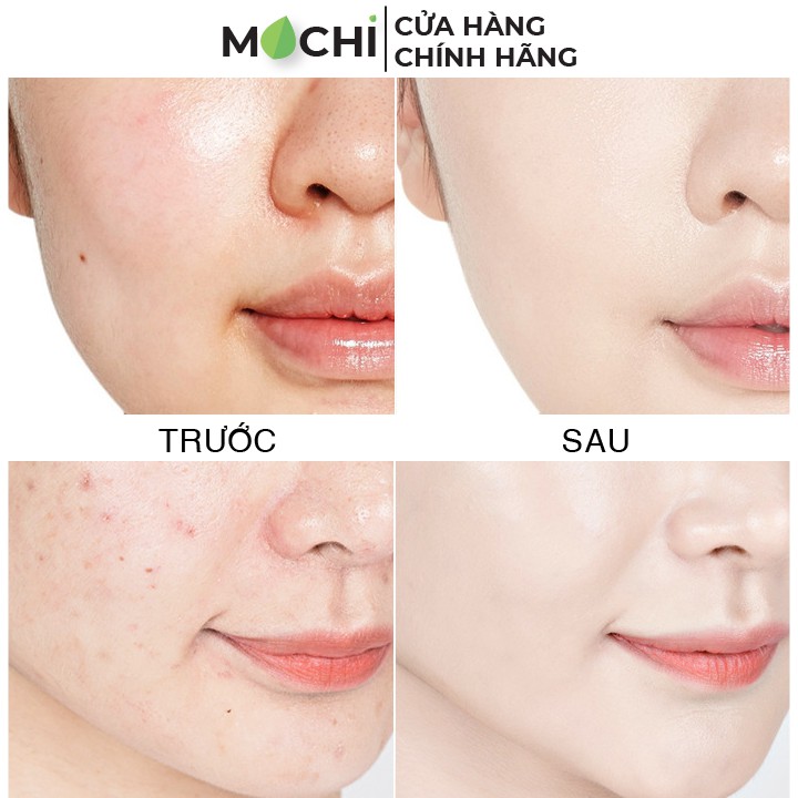 Mặt Nạ Nhau Thai Cừu Tế Bào Gốc Nhật Bản Stem Cell Rwine Beauty Trẻ Hóa, Trắng Da, Dưỡng Ẩm Chính Hãng - MOCHI SHOP