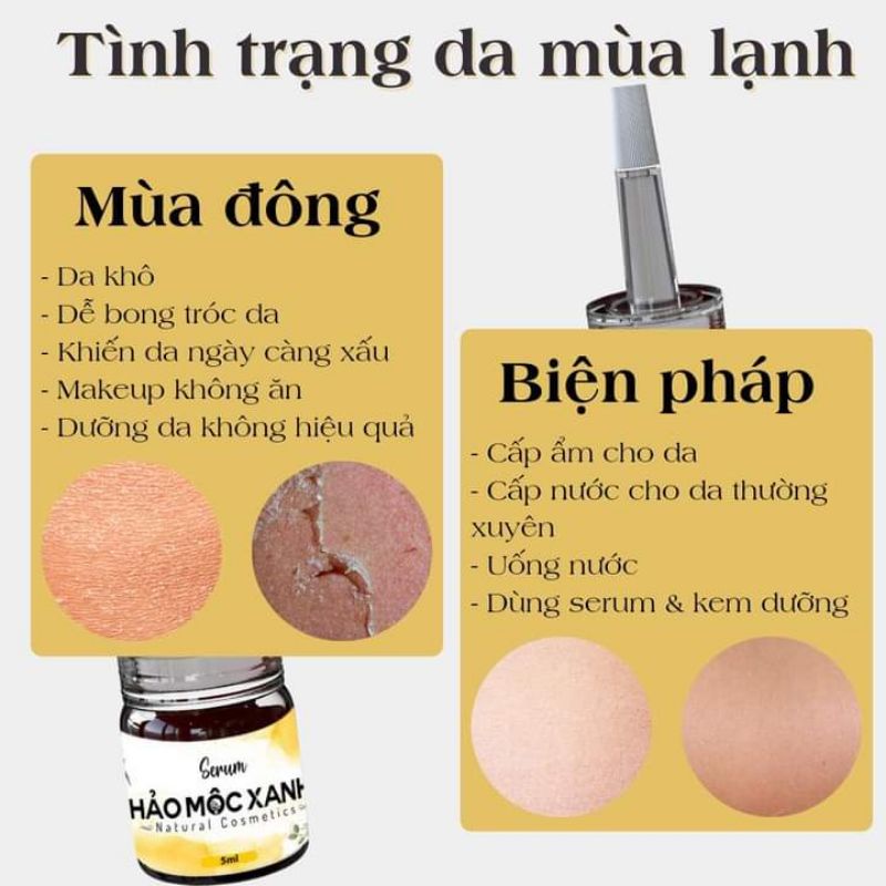 (CHÍNH HÃNG) THẢO MỘC XANH X5 LỌ 5ML | BigBuy360 - bigbuy360.vn