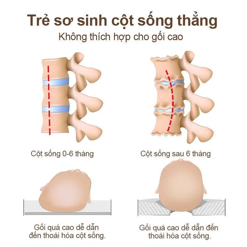 Gối nằm chống bẹp đầu cho bé Chiều cao 0cm