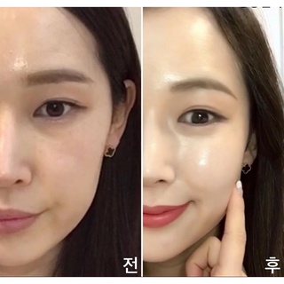 M27_Kem Retinal 1% Lumiderm màu ĐỎ