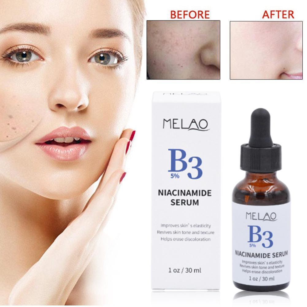 ESSENCE (Hàng Mới Về) Tinh Chất Melao Niacinamide Giàu Vitamin B3 Giúp Dưỡng Ẩm Cho Da S8Z9