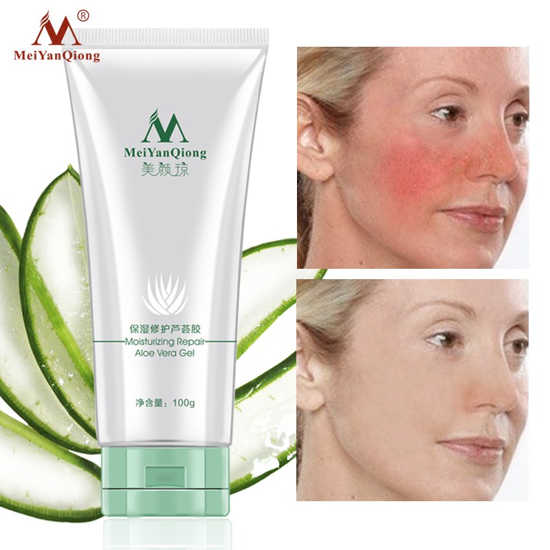 Gel Lô Hội MeiYanQiong Dưỡng Ẩm Cho Da Cao Cấp 100g