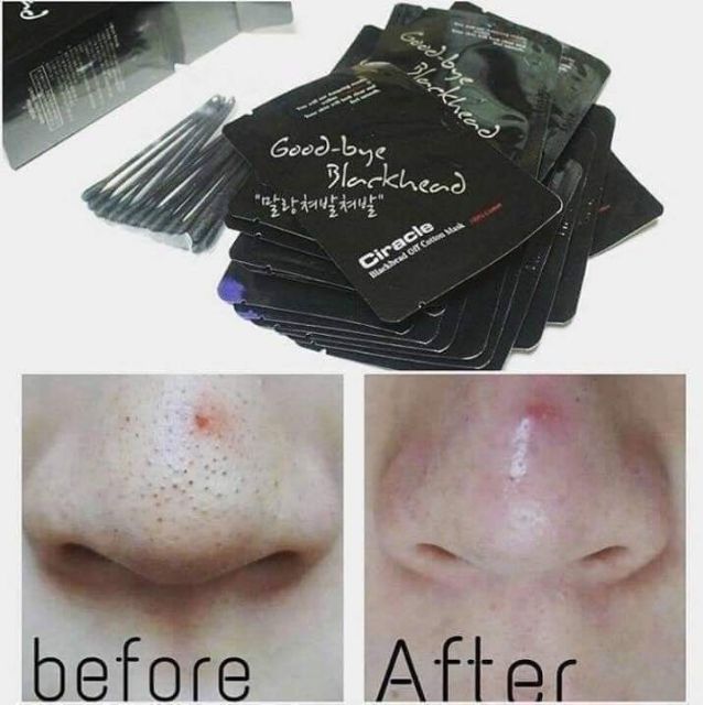 Lột mụn đầu đen- goodbye blackhead