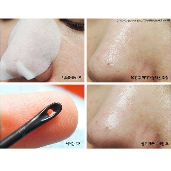 Miếng đẩy mụn Goodbye Blackhead - Tặng que nặn