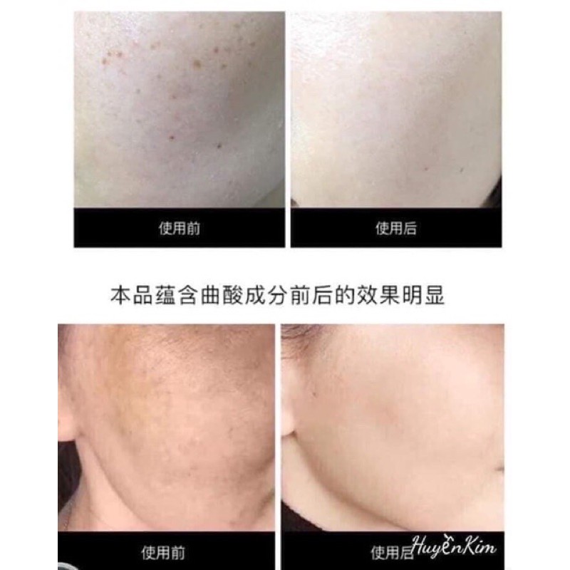 Kem Dưỡng Trắng Da Giãm Nám Dongsung Rannce Cream Mini 10ml | BigBuy360 - bigbuy360.vn