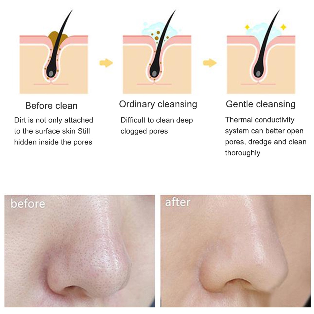 Foreverlily Máy rửa mặt Deep Face Cleaning Tools Cleaning Brush Beauty Tool