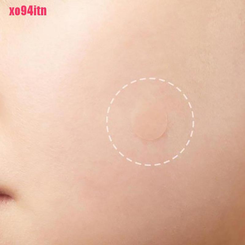 [Hàng mới về] Set 36 miếng dán hỗ trợ giảm mụn hydrocolloid hiệu quả