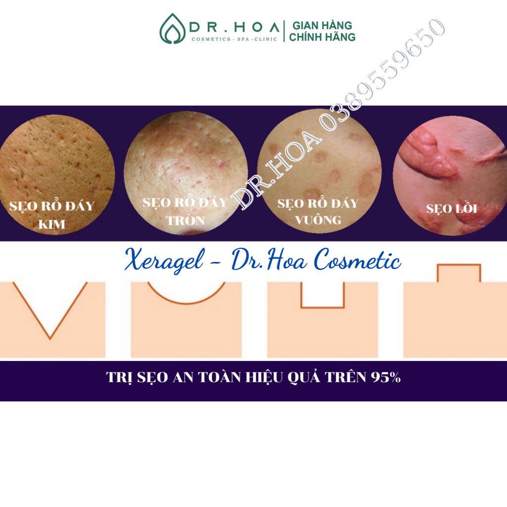 ✔️ Kem Sẹo Cao Cấp Xeragel 10g USA