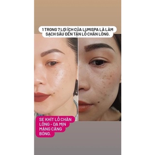 Sữa Rửa Mặt LUMISPA - Dành Cho Máy Rửa Mặt LumiSpa