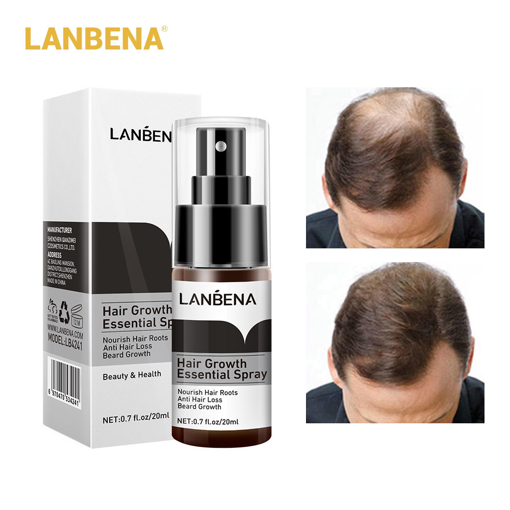 Tinh Chất Xịt Dưỡng Tóc LANBENA Chăm Sóc Gốc Tóc Chống Rụng Chống Hói Đầu 20ml