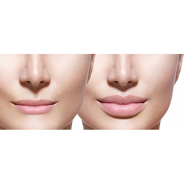 Ampoule Thu gọn Môi