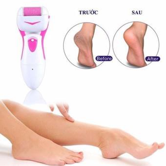 Máy Chà Gót Chân Tẩy Tế Bào Chết Shinon