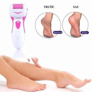 Máy chà gót chân tẩy tế bào chết shinon
