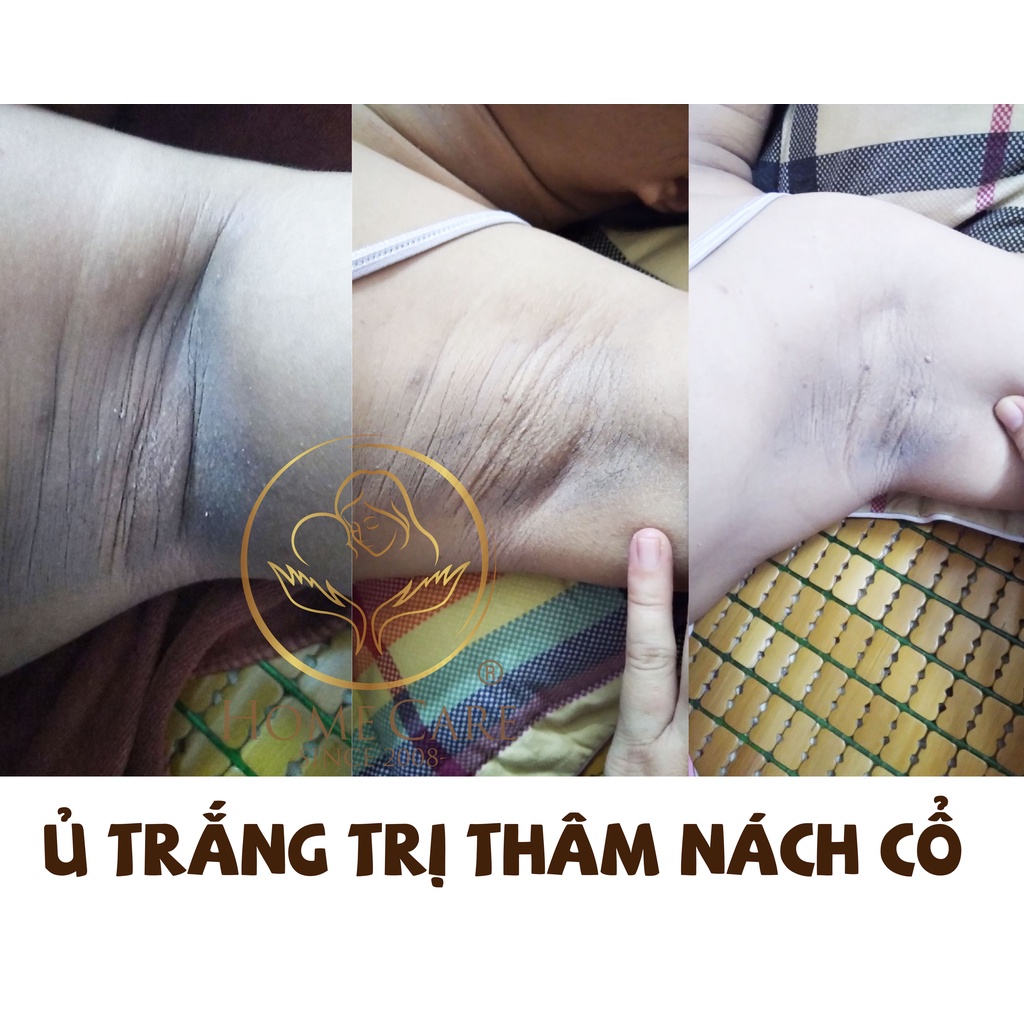 Ủ trắng body Phục Linh Home Care 220ml