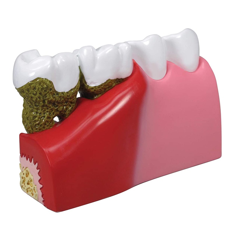 Mô Hình Răng Giả 7x5.9x5.1inches Dùng Trong Học Tập