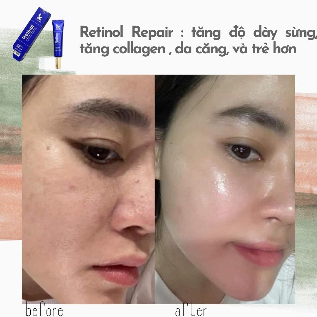 Retinol Repair 0.5% 30ml, tái tạo, trẻ hóa da, trắng da, mờ thâm nám tàn nhang HÂN KOREA