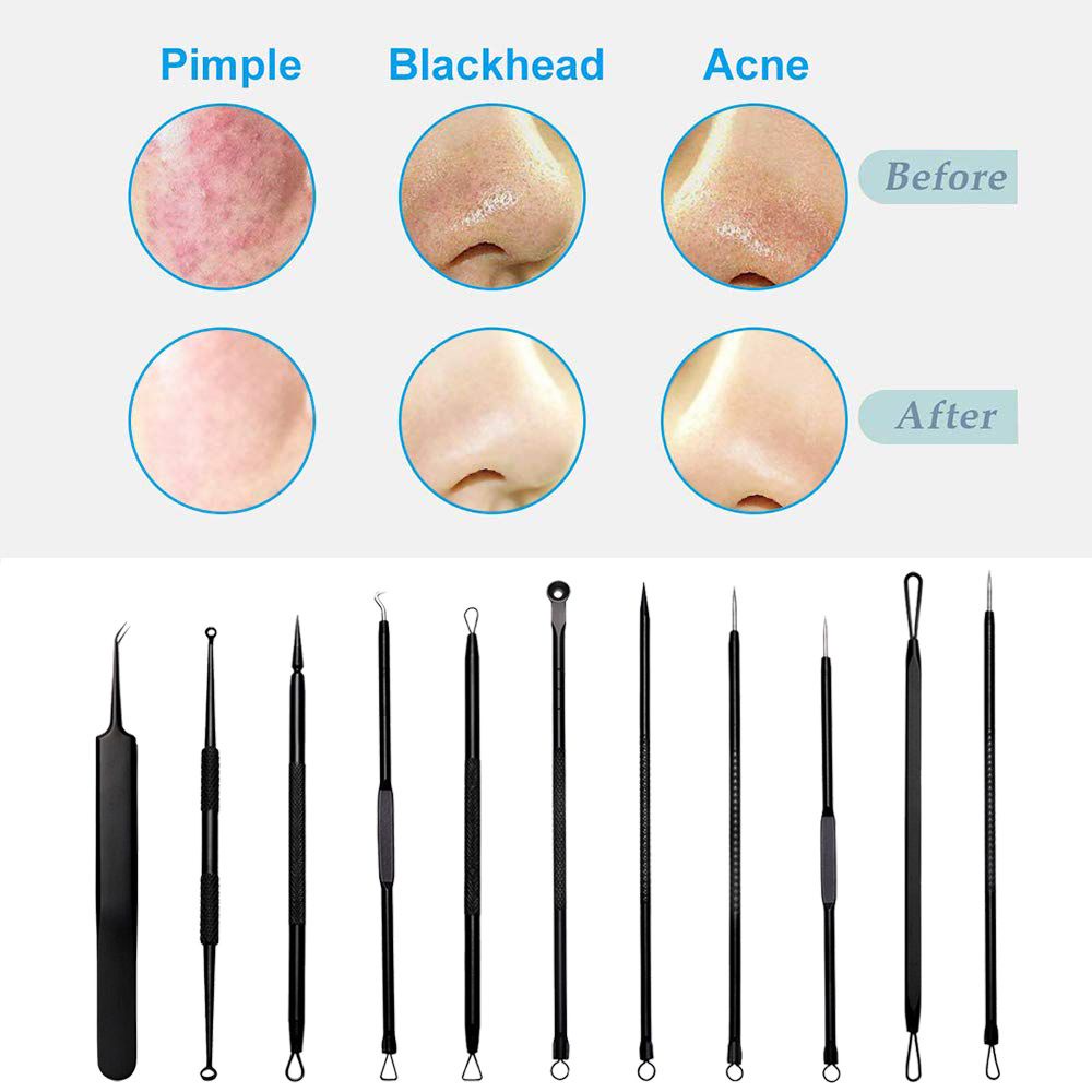 [Hàng mới về] Set dụng cụ loại bỏ mụn đầu đen hai đầu bằng thép không gỉ chăm sóc da có hộp đựng dành cho nữ