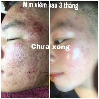 THUỐC THAY DA BẠCH LINH 02. CHUYÊN MỤN