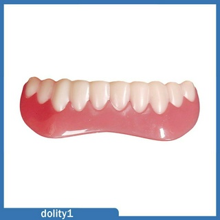 [Dolity1] Veneers trên dưới giả sáng