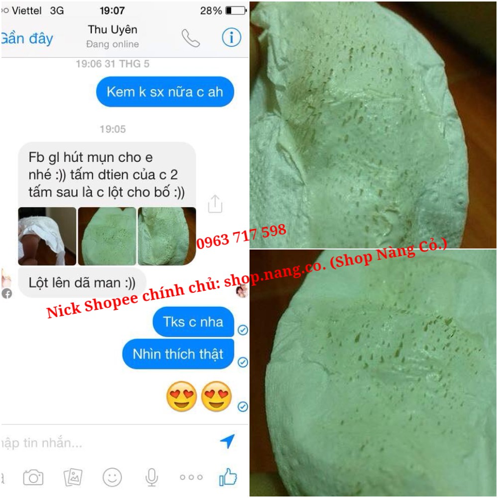 Gel Hút Mụn Bạc Hà, Mặt nạ Gel lột mụn Ngân Bình chính hãng gel lột mụn cám, mụn đầu đen, da chết, lông tơ, bụi bẩn