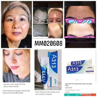 KEM A313 BẢN NỘI ĐỊA PHÁP (RETINOL A313)