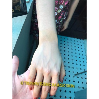 [Trắng cấp tốc] ủ truyền trắng - Thải độc da Magic Skin