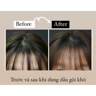 Dầu Gội Khô Cherry 🍒