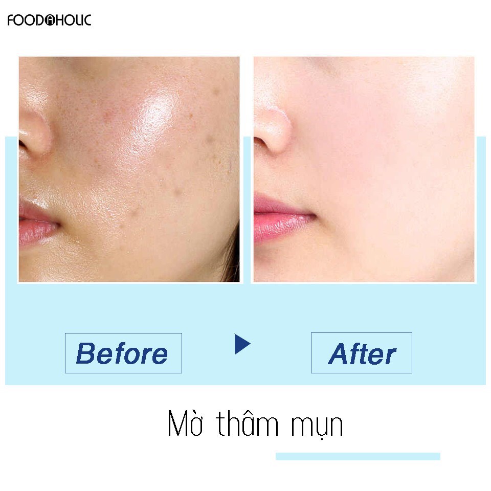 Mặt Nạ Foodaholic Vitamin C  Dưỡng Ẩm, Sáng Da Derma Brightening Mask With Vitamin C 23g