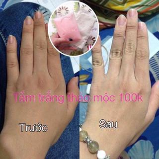 Tắm trắng thảo mộc