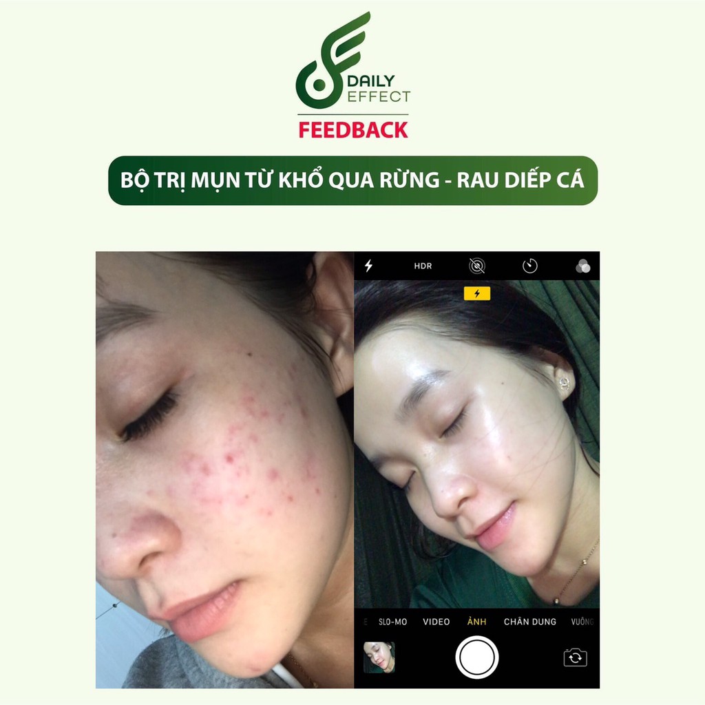 Kem Mờ Thâm Daily Effect | BigBuy360 - bigbuy360.vn