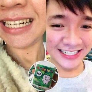 BỘT TRẮNG RĂNG BAKINGSODA 50k