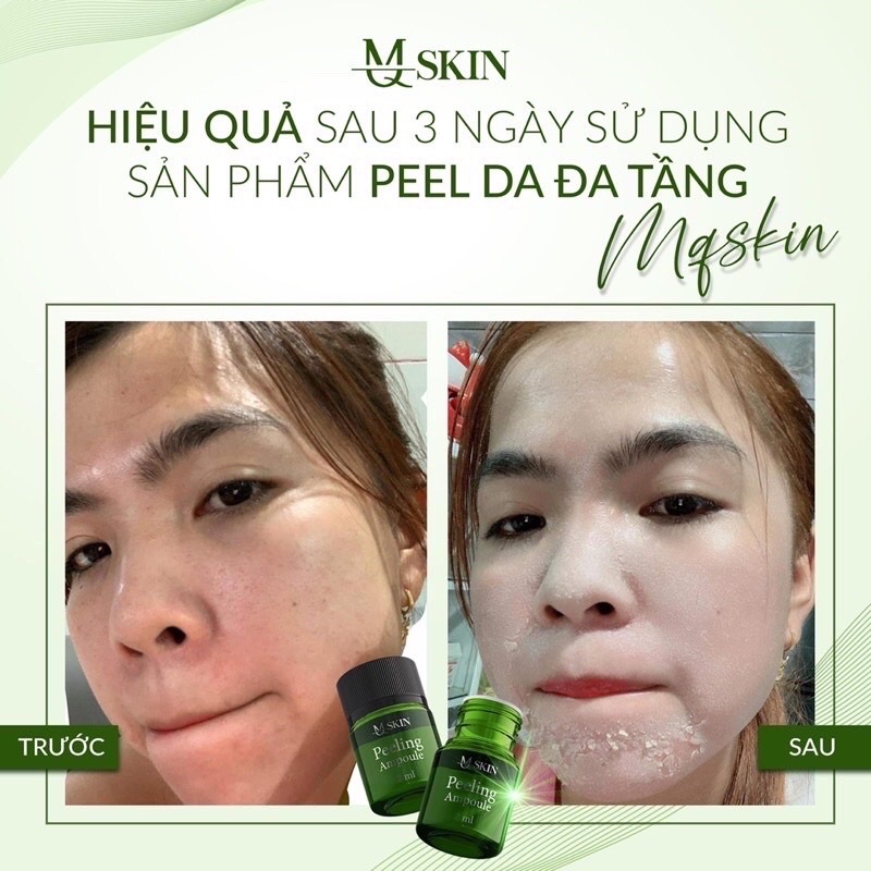 Tái tạo da sinh học đa tầng MQ SKIN