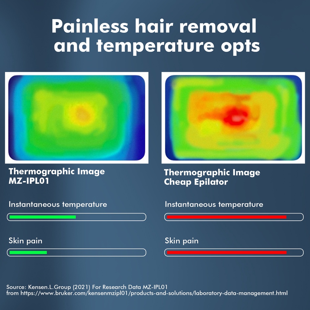 Đèn Thạch Anh IPL Tẩy Lông Toàn Thân Không Đau Trực Tiếp