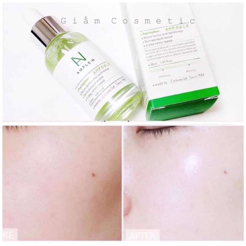 Peeling amplen THAY DA SINH HỌC THẾ HỆ MỚI KHÔNG BONG TRÓC AMPLEN