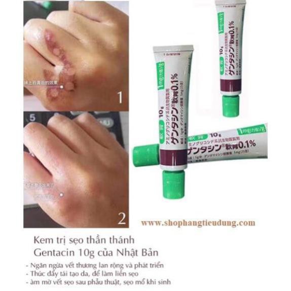 Kem ngăn ngừa mụn, kem mờ sẹo Gentacin Nhật Bản. | BigBuy360 - bigbuy360.vn