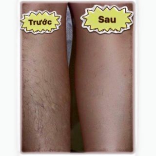 Miếng dán tẩy lông Body Veet ( 6 miếng )

.Made in Germany