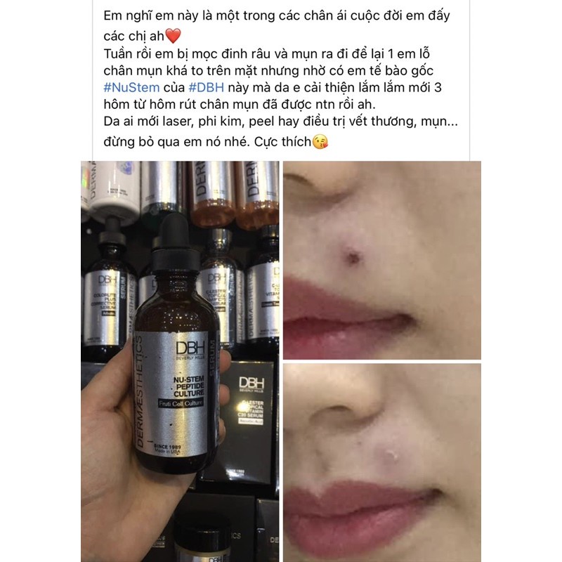 Tinh Chất Serum DBH NUSTEM PEPTIDE CULTURE .