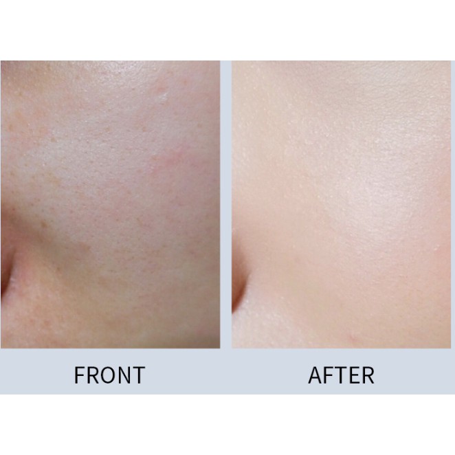 Kem Dưỡng Serum Se Khít LỔ CHÂN LÔNG Senana thu nhỏ mịn ma trắng hồng sạch khoẻ nội địa 20g sỉ rẻ makeup | BigBuy360 - bigbuy360.vn