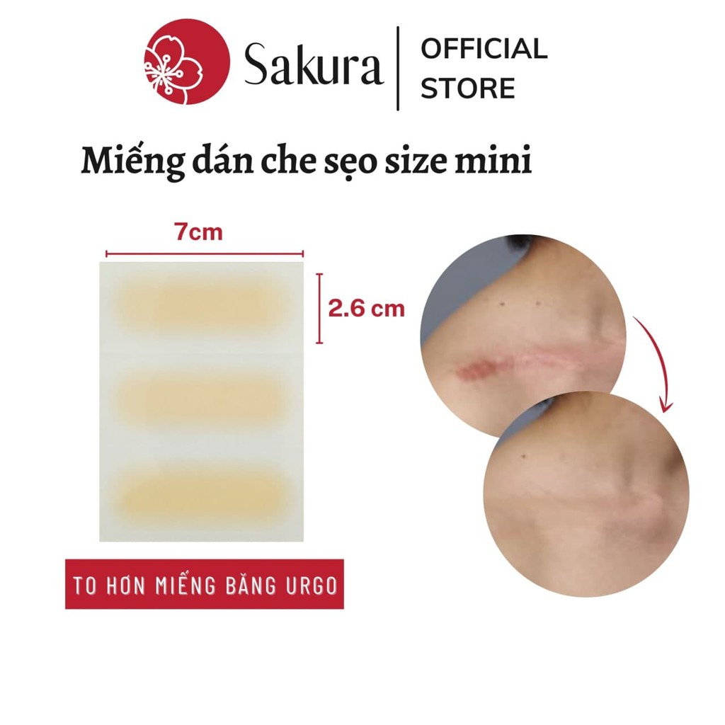 Miếng dán che sẹo mini nhật bản 2.6x7cm che khuyết điểm che sẹo lồi sẹo lõm sẹo thâm, chống nước 3-5 ngày