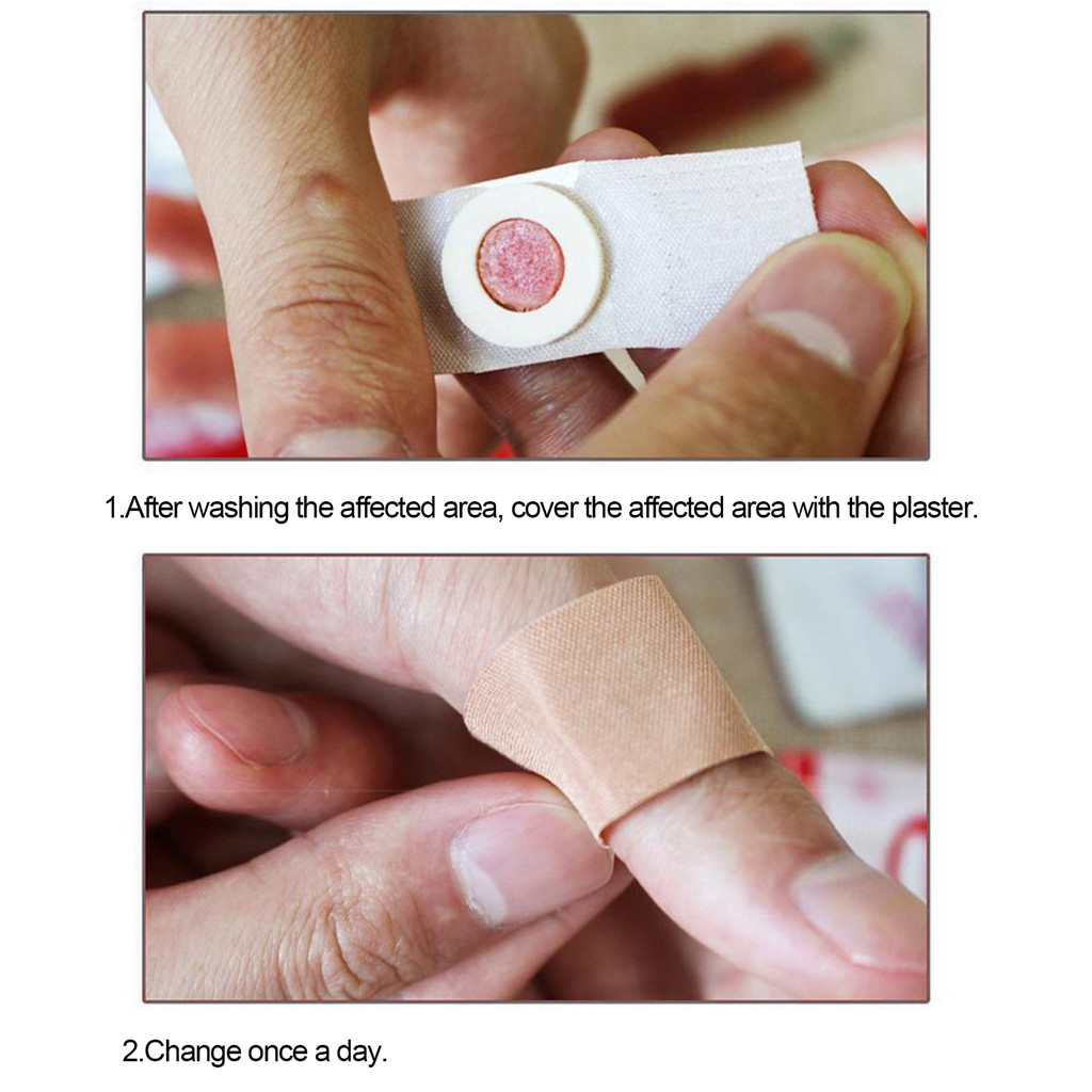 (Hàng Mới Về) Bộ 42 Miếng Dán Trị Mụn Cóc Chất Lượng Cao | BigBuy360 - bigbuy360.vn