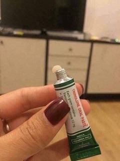 KEM BÔI NHIỆT MIỆNG