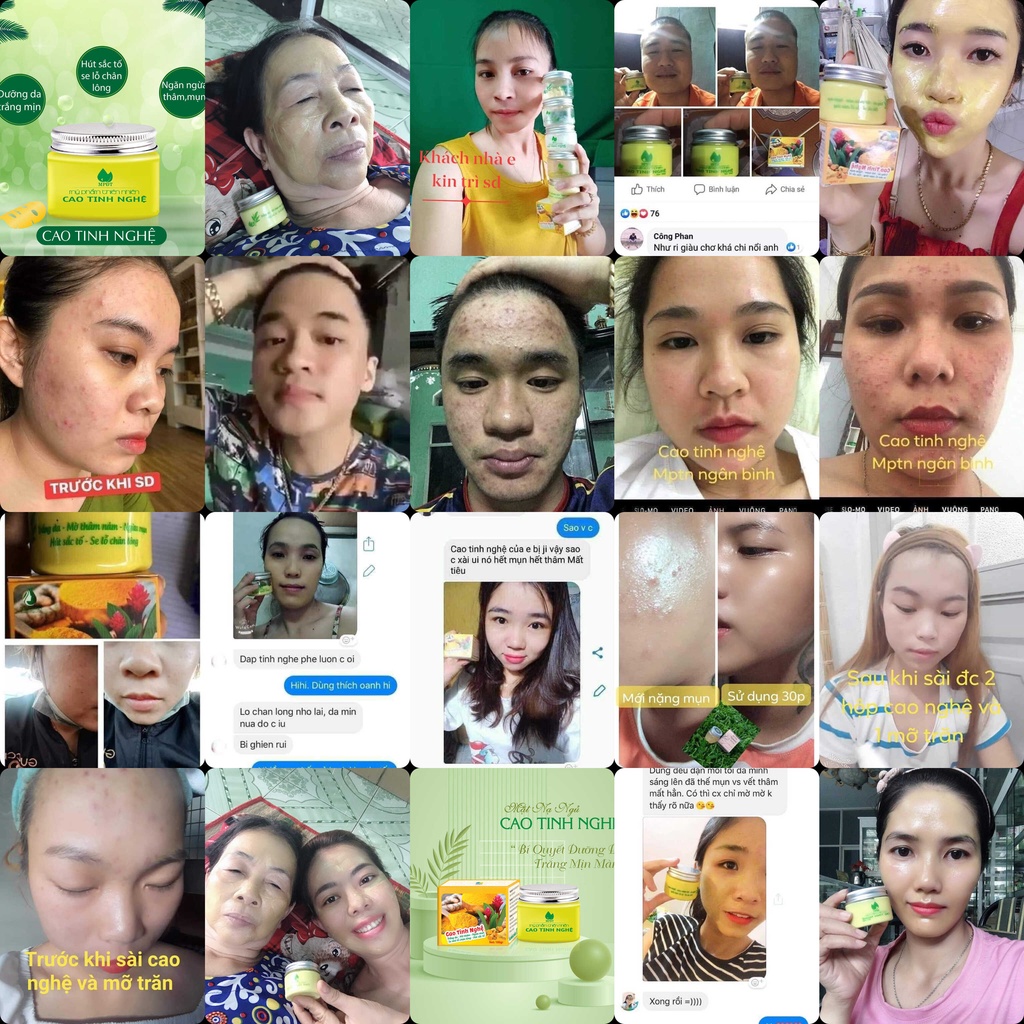 Cao Tinh Nghệ NGÂN BÌNH - Mặt nạ ngủ Cao Tinh Nghệ, Trắng hồng da, mờ thâm, nám, tàn nhang, se lỗ chân lông, giảm mụn