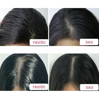 DẦU GỘI KHÔ