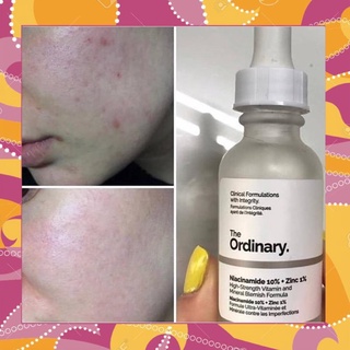 Bv tinh chất dưỡng the ordinary niacinamide 10% + zinc 1% 30ml