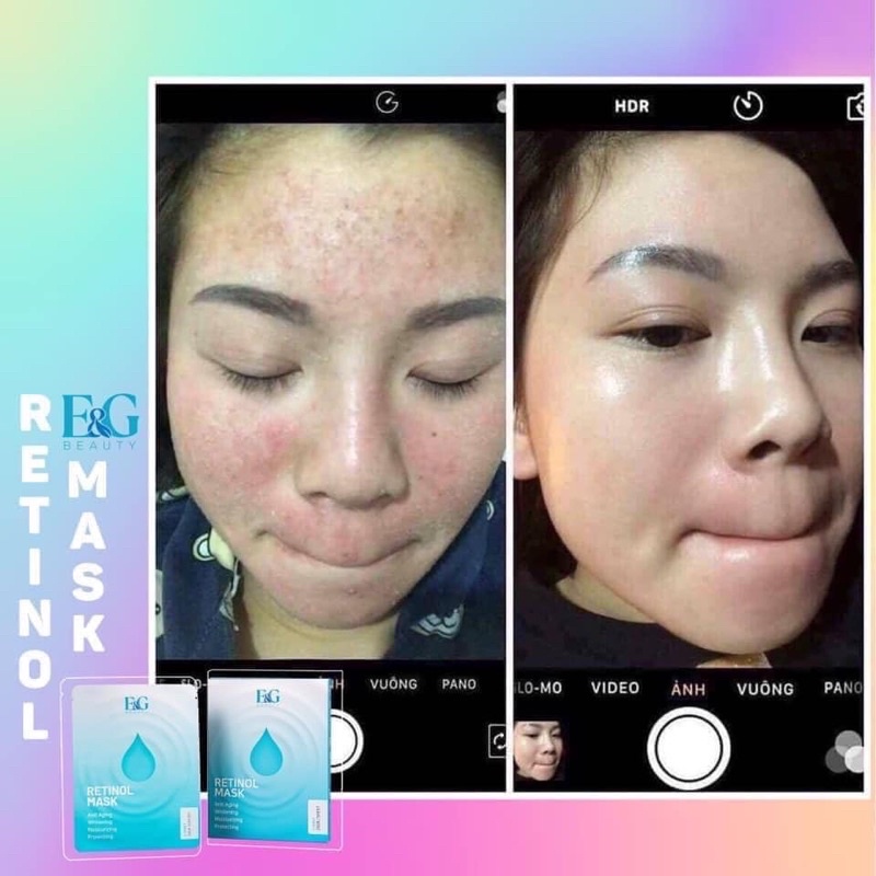 Mặt nạ retinol mask E&amp;G Beauty hộp 3 miếng